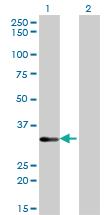 Anti-STK16 Mouse Monoclonal Antibody [clone: M2]