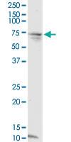 Anti-SPDL1 Mouse Monoclonal Antibody [clone: 2F4]