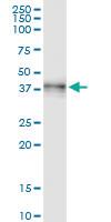 Anti-CD207 Rabbit Polyclonal Antibody