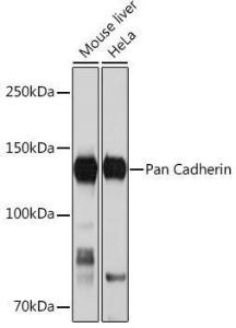 Anti-pan Cadherin Rabbit Monoclonal Antibody [clone: ARC1135]