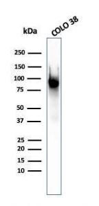 Western blot analysis of COLO-38 cell lysate using Anti-Melanoma gp100 Antibody [PMEL/2037]