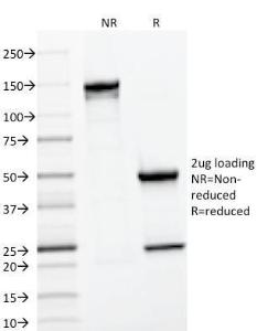 SDS-PAGE analysis of Anti-CD22 Antibody [BLCAM/1796] under non-reduced and reduced conditions; showing intact IgG and intact heavy and light chains, respectively. SDS-PAGE analysis confirms the integrity and purity of the antibody.