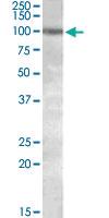 Anti-PKD2 Goat Polyclonal Antibody