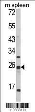 Anti-FKBP11 Rabbit Polyclonal Antibody (AP (Alkaline Phosphatase))