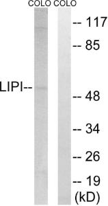 Anti-LIPI Rabbit Polyclonal Antibody