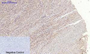 Immunohistochemical analysis of paraffin-embedded human uterus tissue using Anti-JAK1 Antibody at 1:200 (4°C overnight) Negative control was secondary antibody only