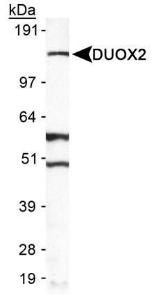 Anti-DUOX2 Rabbit Polyclonal Antibody