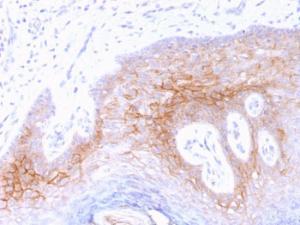 Immunohistochemical analysis of formalin-fixed, paraffin-embedded human skin using Anti-Desmocollin 2 Antibody [7G6]