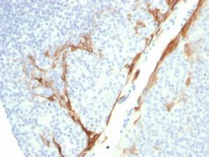 Anti-Cytokeratin 16 Mouse Recombinant Antibody [clone: rKRT16/1714]