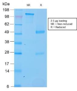 SDS-PAGE analysis of Anti-SOX2 Antibody [SOX2/3169R] under non-reduced and reduced conditions; showing intact IgG and intact heavy and light chains, respectively. SDS-PAGE analysis confirms the integrity and purity of the Antibody