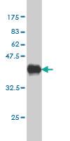 Anti-PHLDA2 Mouse Monoclonal Antibody [clone: 5E3]