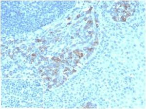 Antibody anti-CD5L CD5L4420 BSA 100 µg