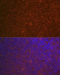 Immunofluorescence analysis of mouse spleen using Anti-Carma 1/CARD11 Antibody [ARC1680] (A305673) at a dilution of 1:100 (40X lens). DAPI was used to stain the cell nuclei (blue)