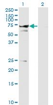 Anti-STXBP1 Mouse Monoclonal Antibody [clone: 6D1]