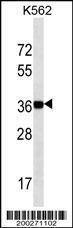 Anti-NANOG Mouse Monoclonal Antibody [clone: 60CT77.1.1]