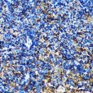 Immunohistochemistry analysis of paraffin-embedded mouse spleen using Anti-GMIP Antibody (A307109) at a dilution of 1:100 (40X lens)