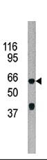 Anti-KCNK18 Rabbit Polyclonal Antibody