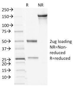 SDS-PAGE analysis of Anti-Desmocollin 2 Antibody [7G6] under non-reduced and reduced conditions; showing intact IgG and intact heavy and light chains, respectively SDS-PAGE analysis confirms the integrity and purity of the antibody