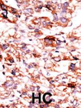 Anti-KCNK18 Rabbit Polyclonal Antibody