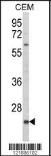 Anti-KLRC2 Rabbit Polyclonal Antibody