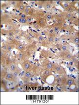 Anti-TRPM8 Rabbit Polyclonal Antibody