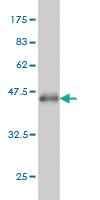 Anti-PAPSS2 Mouse Monoclonal Antibody [clone: 2A8]