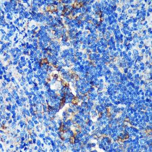 Immunohistochemistry analysis of paraffin-embedded rat spleen using Anti-GMIP Antibody (A307109) at a dilution of 1:100 (40X lens)