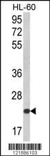 Anti-KLRC2 Rabbit Polyclonal Antibody