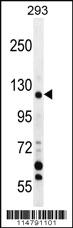 Anti-TRPM8 Rabbit Polyclonal Antibody