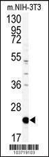 Anti-Prostatic Binding Protein Rabbit Polyclonal Antibody (AP (Alkaline Phosphatase))