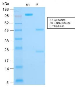 Anti-Cytokeratin 16 Mouse Recombinant Antibody [clone: rKRT16/1714]