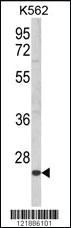 Anti-KLRC2 Rabbit Polyclonal Antibody