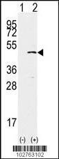 Anti-SETD7 Rabbit Polyclonal Antibody (HRP (Horseradish Peroxidase))