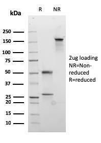 SDS-PAGE analysis of Anti-Desmocollin 2 Antibody [rDSC2/3437] under non-reduced and reduced conditions; showing intact IgG and intact heavy and light chains, respectively. SDS-PAGE analysis confirms the integrity and purity of the antibody