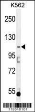 Anti-AGBL5 Rabbit Polyclonal Antibody (AP (Alkaline Phosphatase))