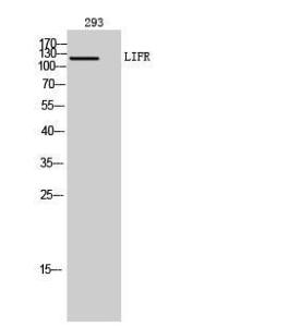 Western blot analysis of 293 cells using Anti-LIFR Antibody