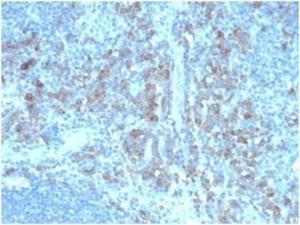 Antibody anti-CD5L CD5L4420 BSA 100 µg