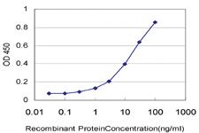 Anti-NUP62 Mouse Monoclonal Antibody [clone: 2D3]