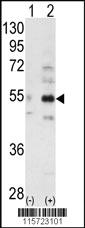 Anti-STRADB Rabbit Polyclonal Antibody