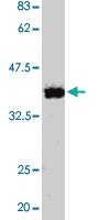 Anti-RAD51 Rabbit Polyclonal Antibody