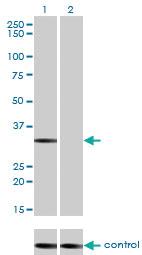 Anti-STK16 Mouse Monoclonal Antibody [clone: M2]