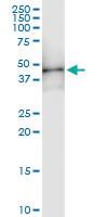 Anti-HOXD1 Polyclonal Antibody Pair