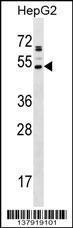 Anti-AADACL2 Rabbit Polyclonal Antibody (PE (Phycoerythrin))