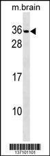 Anti-PAFAH1B2 Rabbit Polyclonal Antibody