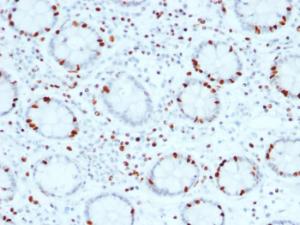 Anti-SOX4 Mouse Monoclonal Antibody [clone: SOX4/2540]