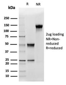 Antibody anti-CD5L CD5L4420 BSA 100 µg