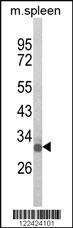 Anti-SF1 Rabbit Polyclonal Antibody