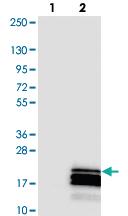 Anti-C17ORF64 Rabbit Polyclonal Antibody