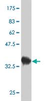 Anti-ZAK Mouse Monoclonal Antibody [clone: 3B6]