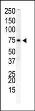 Anti-PIP5K1B Rabbit Polyclonal Antibody (PE (Phycoerythrin))